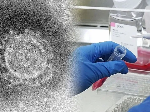 Việt Nam bắt đầu thử nghiệm thuốc điều trị virus corona